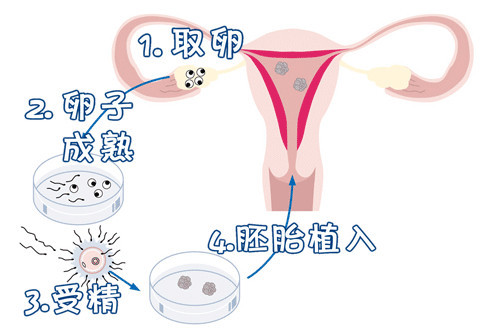 Dr. Zhang